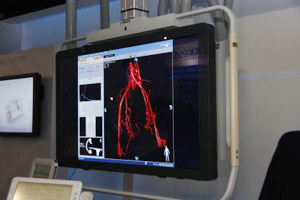 Allura Xper FD2056C`׉tj^ 