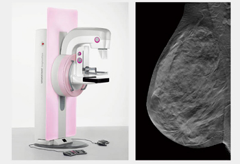 {lɓLȓBx̍[ɂ鑁̌oオ҂u3D Tomosynthesis with MAMMOMAT Inspirationv