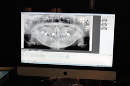 ㎕AgɂȂƂȗ̈CAD