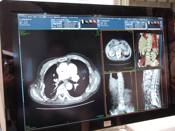 HOPE/DrABLE-GXの2Dと3D画像表示