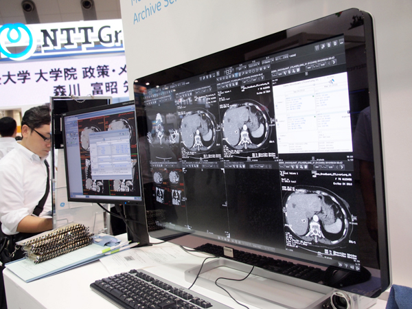 読影医の負担を軽減し,読影効率を上げるCentricity PACS 4.0