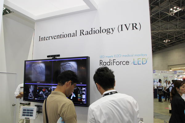 IVR手術室用の60型カラー液晶モニタ「RadiForce LX600W」。操作室側の4MPのカラー液晶との組み合わせのスタイルで提案