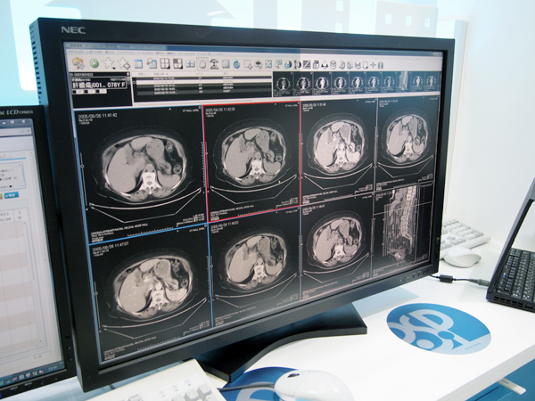 PACSのEV Insite Net