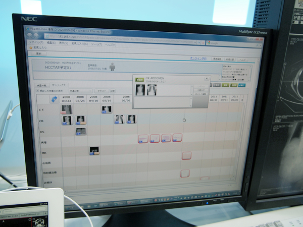 地域医療連携での利便性に優れたPSA