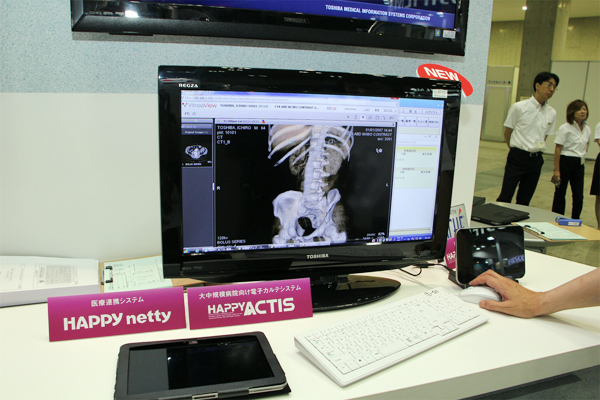 HAPPY nettyの3D画像参照機能を参考展示