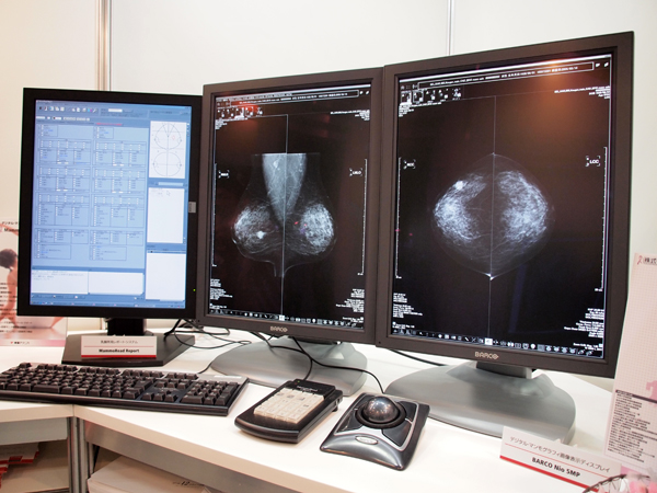 マンモグラフィビューワのMammoRead