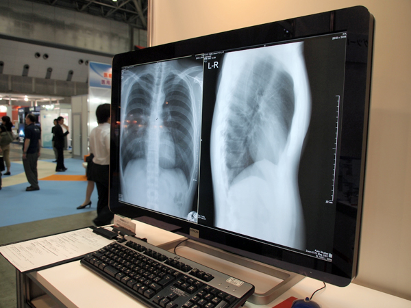 バルコのCoronis Fusion 6MP