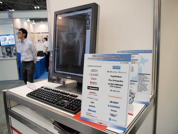 圧倒的シェアを持つOrthoPlanner Pro