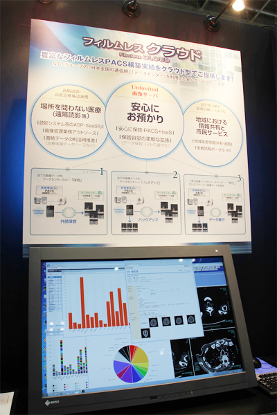 PACSのクラウドサービス「フィルムレスクラウド」を紹介
