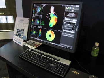 Fusion EXiSPECT{CTjFSPECTCT̗Z摜BГƎ̃AgXf[^ɂʒu킹̐x啝ɉPꂽBuYAC\ɂCƍ[ǂ^镔ʂƂ̊֌WeՂɊώ@邱ƂłB