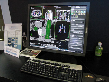 COPDaώFCT摜ƂɁCCǎxaςƋCaς̐ffsBCǎxoEOǌaCz̐ϑȂǂ\BɁCNBrigham & Womenfs HospitalƂCOPD\tgEGAJɌJnB