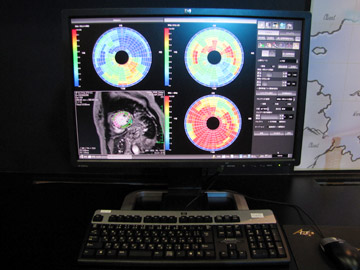 MRxeF[Ǖaς̍LCuYAC\ɂĎoIɕ]邱ƂłB܂CV3ނ̃uYACʏɕ\ł悤ɂȂقC͋@\ǉƂŁCׂẴXCXɑ΂Ď͂\ƂȂB