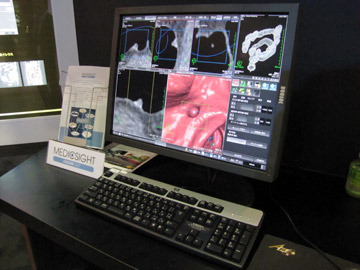 咰̓\tgEFAFCT摜ɑ咰IɒoCȒPȑő咰o]łBWJ摜̕\͂CfW^NWO≼z摜PET摜Ƃ̗Z摜\邱ƂłBfBbNTCgЂ̃Rs[^xffiCADjɂΉĂB