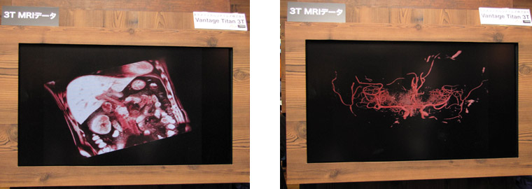 AZE VirtualPlaceɂC3T MRI摜\