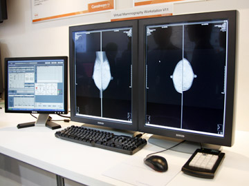 Carestream Virtual Mammography Workstation V11