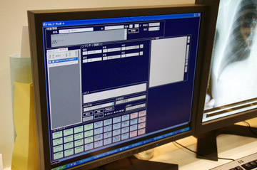 hN^[PACS̃|[gGfB^̌f|[g