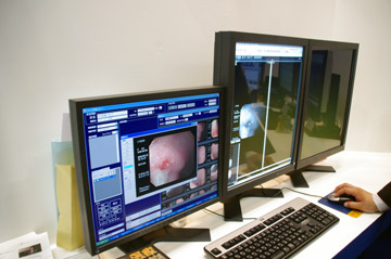 hN^[PACSł̓摜\Ɠ|[gGfB^