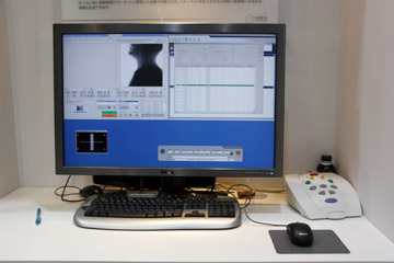 㔭\肵ĂVȃR\[BXVIȂǂ̋@\𓝈ꂵC1̒[Elekta SynergŷׂĂ̐\ɂƂB