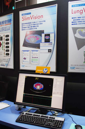 f{݂ȂǂɂKb𑪒肷Slim Vision