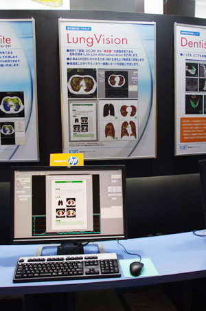 Lung Vision͌vʂOt\\