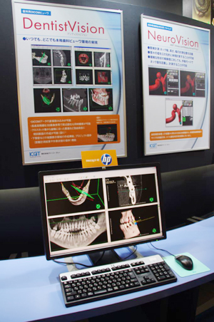 ȗpDICOMr[DentistVision