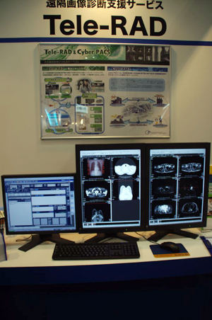 Tele-RADCyber PACS̃f