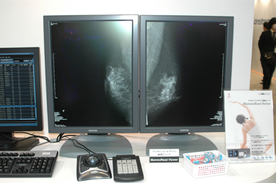 fW^E}OtB摜r[AuMammoRead Viewerv