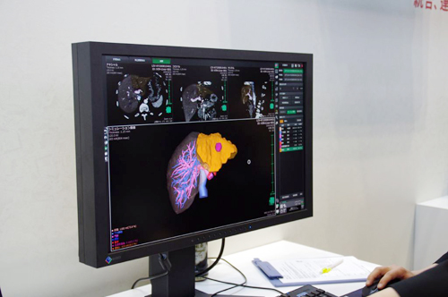 3D[NXe[VSYNAPSE VINCENT