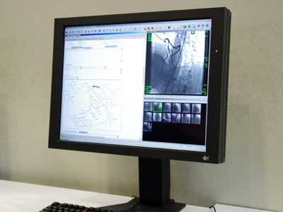 z핔VXeSYNAPSE CardioVascular