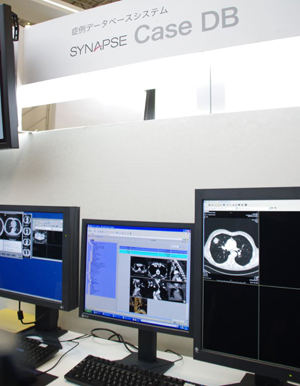 Ǘf[^x[XSYNAPSE Case DB