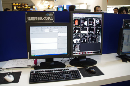 C[TCgwXPAЂ̉uǉeVXe