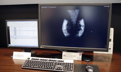 10KsNŹuEIZO RadiForce GX1030vB5K2ʕ̑傫\ł