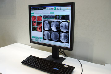 内視鏡・超音波・病理部門システムのNEXUS