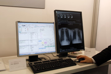 NjbN\[V̓dqJeuHi-SEEDvƉ摜Qƃr[uNV-Lightv