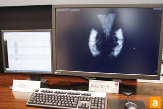 EIZO RadiForce GX1030