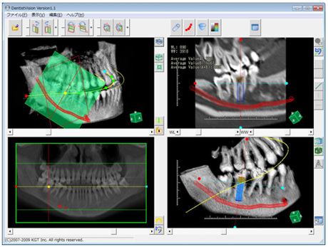 ȗpDICOMr[A wDentistVisionx ifeBXgErWj