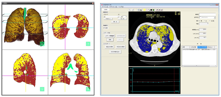 xCv\tgwLungVisionxiOrWj