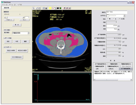 bʐόv\tgwSlimVisionxiXrWj