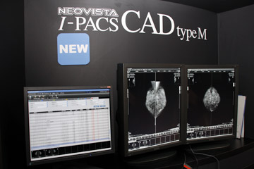 マンモグラフィ診断支援装置「NEOVISTA I-PACS CAD typeM」