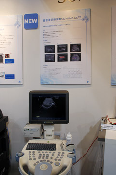開業医向けのカラー超音波画像診断装置「SONIMAGE 513」
