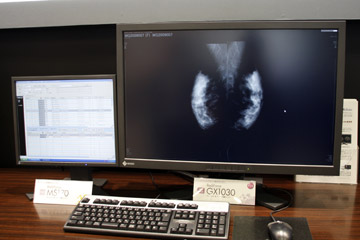 10KsNŹuEIZO RadiForce GX1030vB5K2ʕ1ʂŕ\F⃆[UreBB