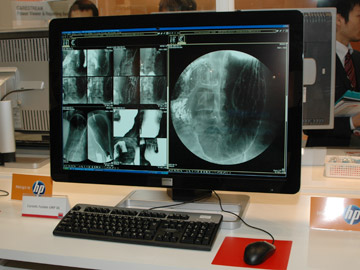 Coronis Fusion 6MP DL 800cd/m2ȏ̍ōPxւCmN摜ƃJ[摜x[Xœɓǉe\B