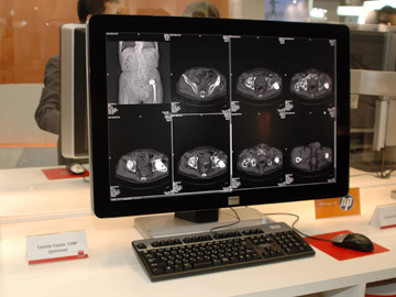 Coronis Fusion 10MPiQloij