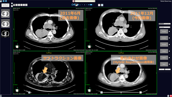 vVI摜ffr[AuAZE VirtualPlace PHOENIXv