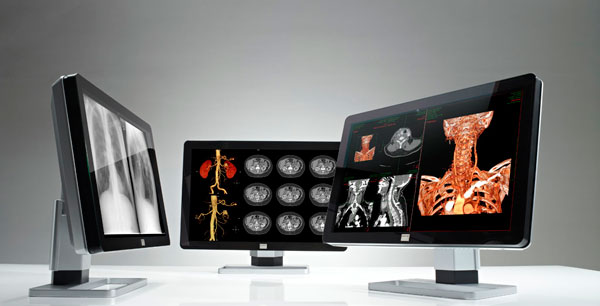 診断用ディスプレイのフラグシップモデルCoronis Fusion シリーズ