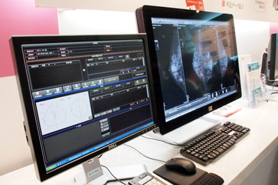 oRЂCoronis Fusion 10MPƑgݍ킹mammary