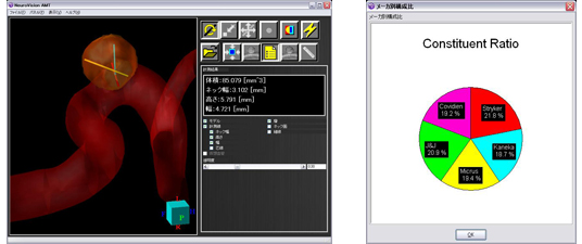 脳動脈瘤塞栓率計測ソフト『NeuroVisionAMT』(ニューロビジョンエーエムティー)
