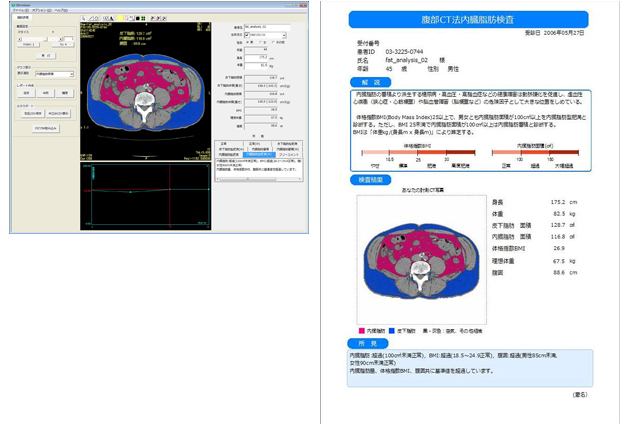 内臓脂肪面積計測ソフト『SlimVision5』(スリムビジョン5)