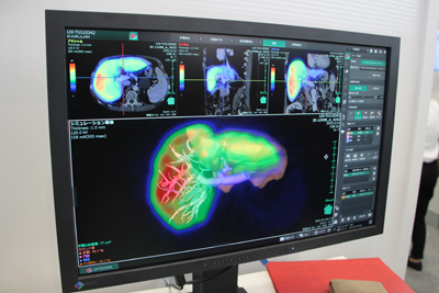 SYNAPSE VINCENT̐V@\ű@\́v