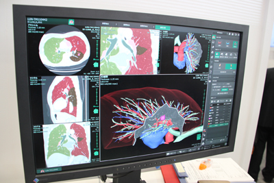 uCǎx́vł́CFGWɂċCǎx̒oB